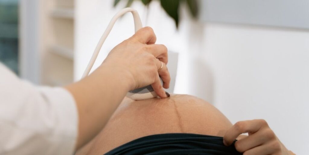 pregnant woman having ang ultrasound